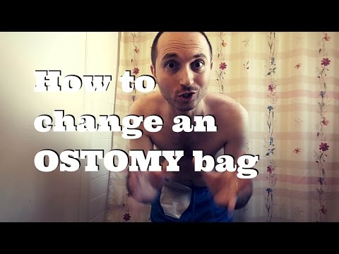 How to Change Your Ostomy Bag: Ostomy Care Tips