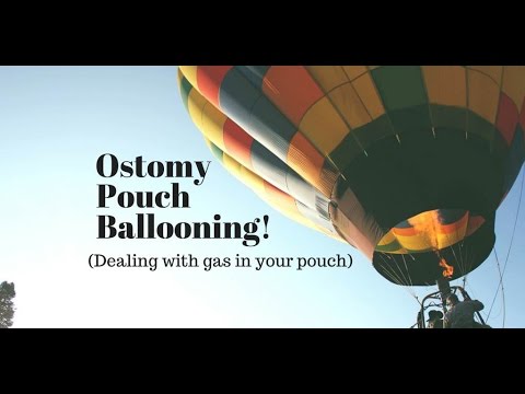 Dealing with Ostomy Pouch Ballooning (gas in your bag)