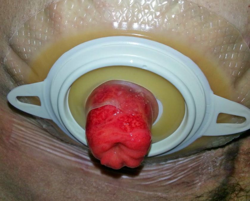 A handsome stoma wearing the Salts Dermacol collar