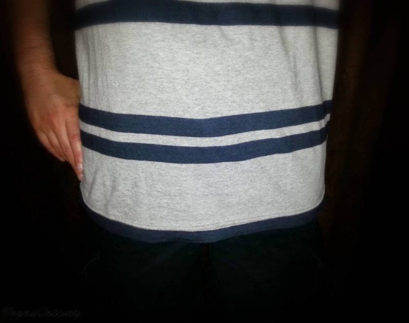 Ostomy Resolutions Stoma Guard REVIEW VeganOstomy