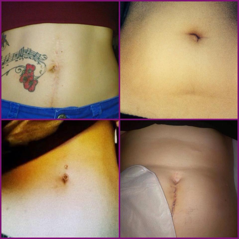 The GetYourBellyOut Team (July 2014)