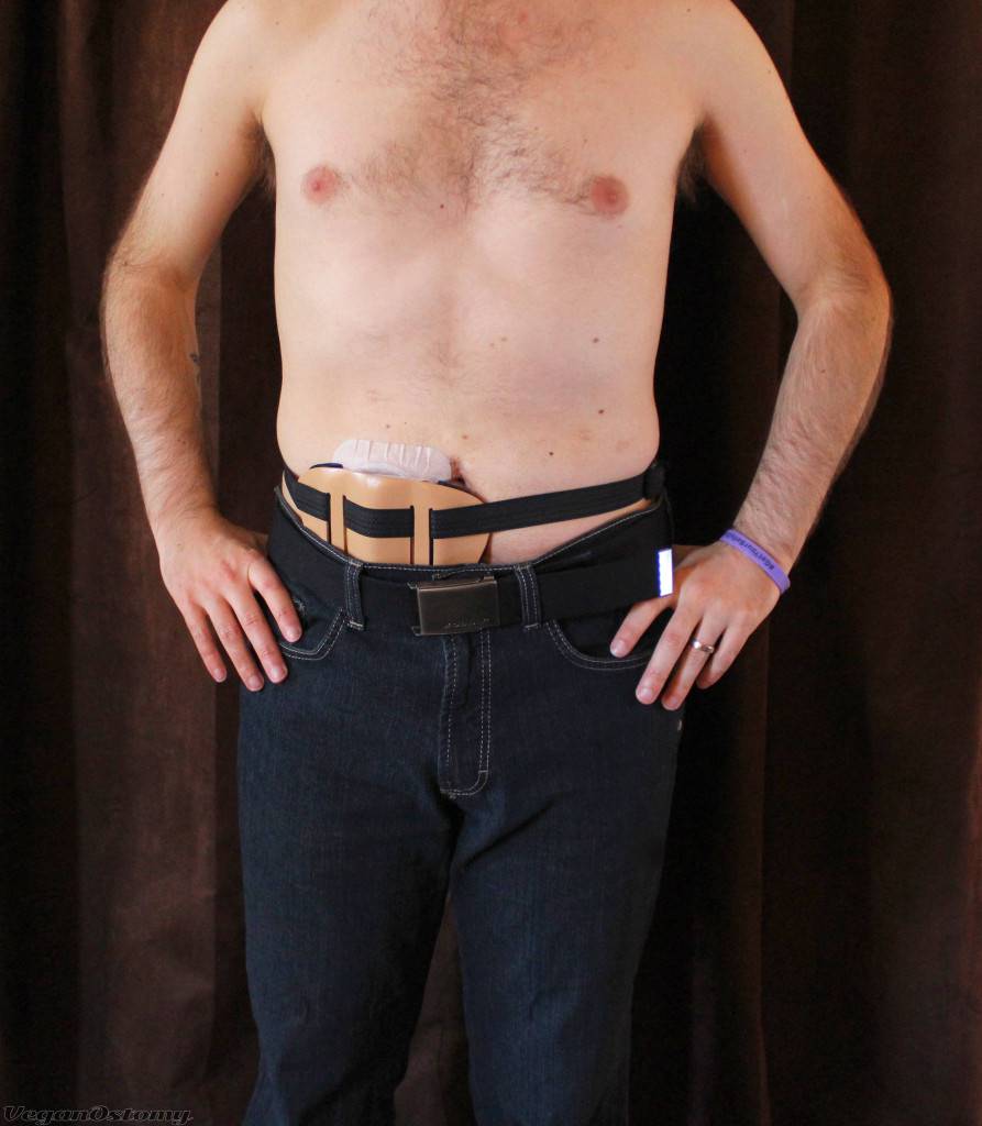 Dressing with an Ostomy A Clothing Guide for Men  VeganOstomy