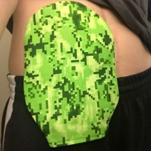 Homemade ostomy pouch cover Front Butt Youtuber