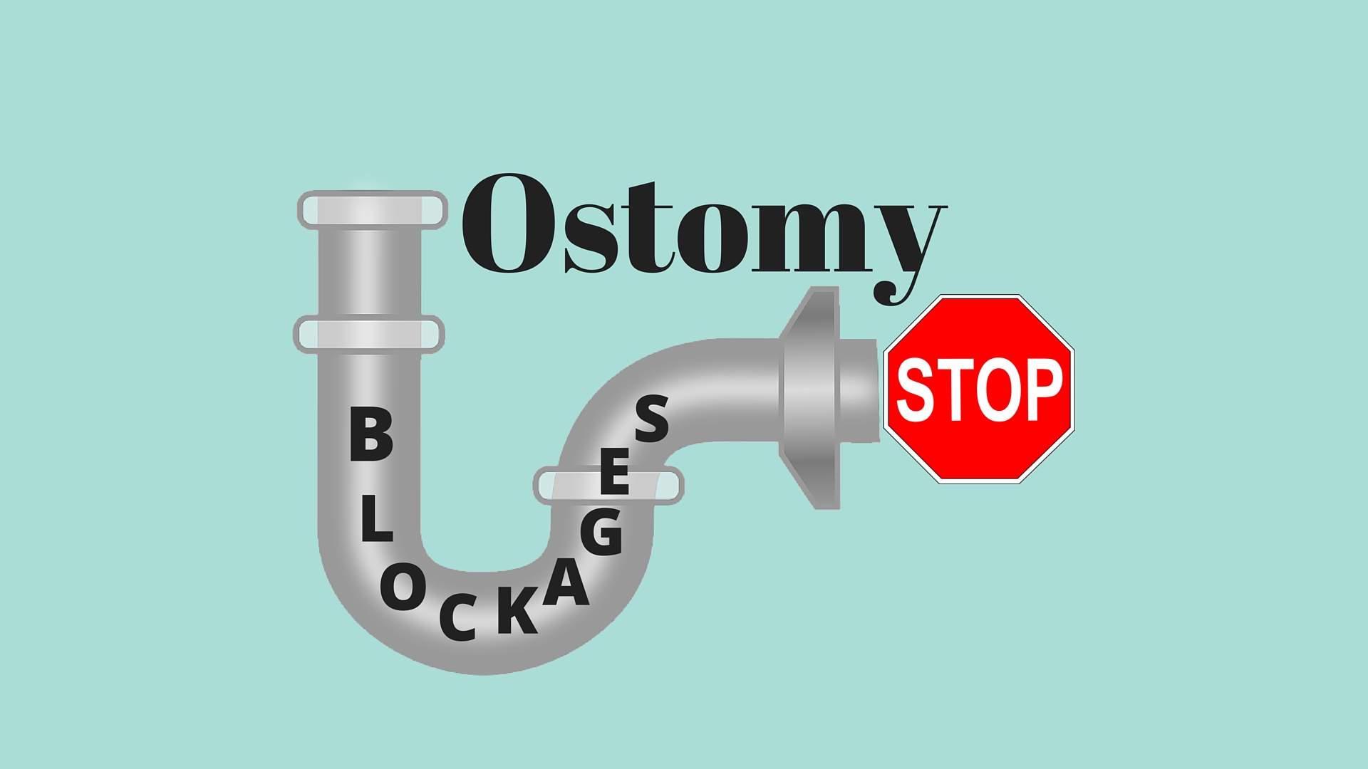 Dealing With Ostomy blockages