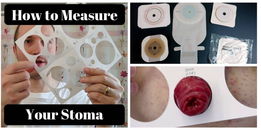 How to Measure your stoma header